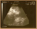 Sierra's ultrasound taken on January 30th, 2008.