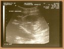 Tangerine's ultrasound taken on November 5th, 2007.